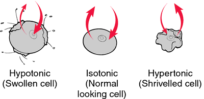 Hypertonic Solution Definition