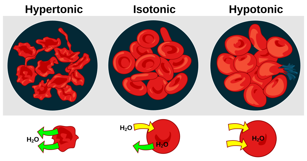 Hypertonic Solution Definition For Kids